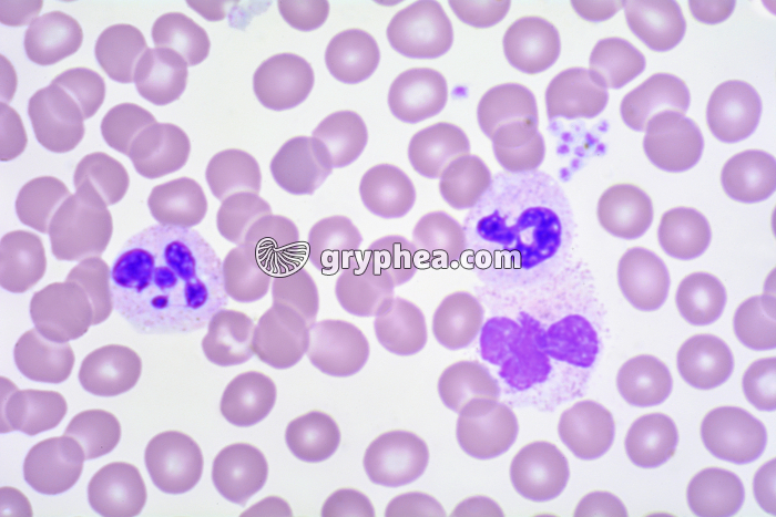 Sang septicémie x400 - gryphea.org